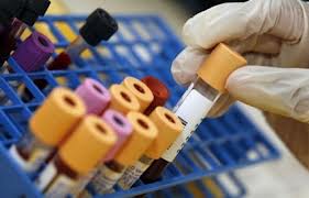 metalli tossici urine e sangue autismo